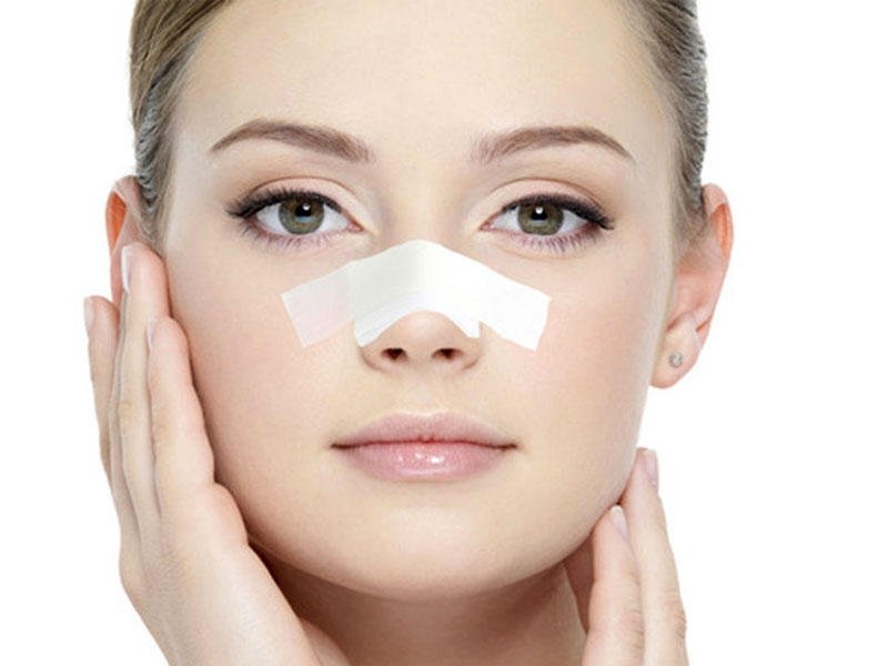 بعد از عمل بینی