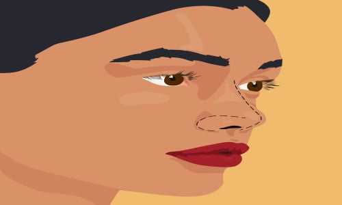 هزینه جراحی زیبایی بینی