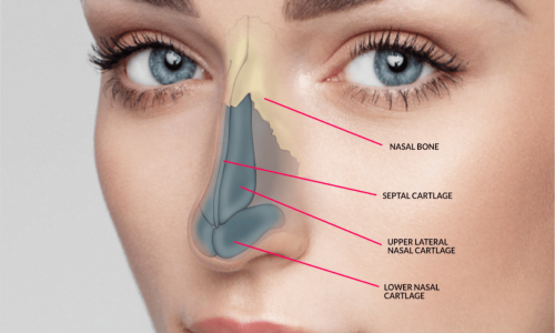 انواع عمل بینی