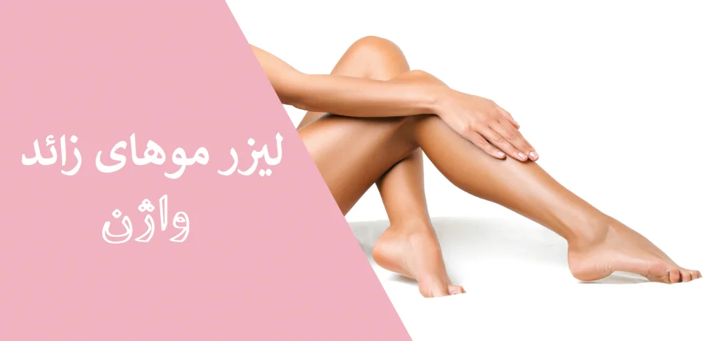 لیزر موی زائد واژن