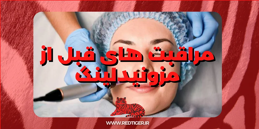 مراقبتهای بعد از مزونیدلینگ